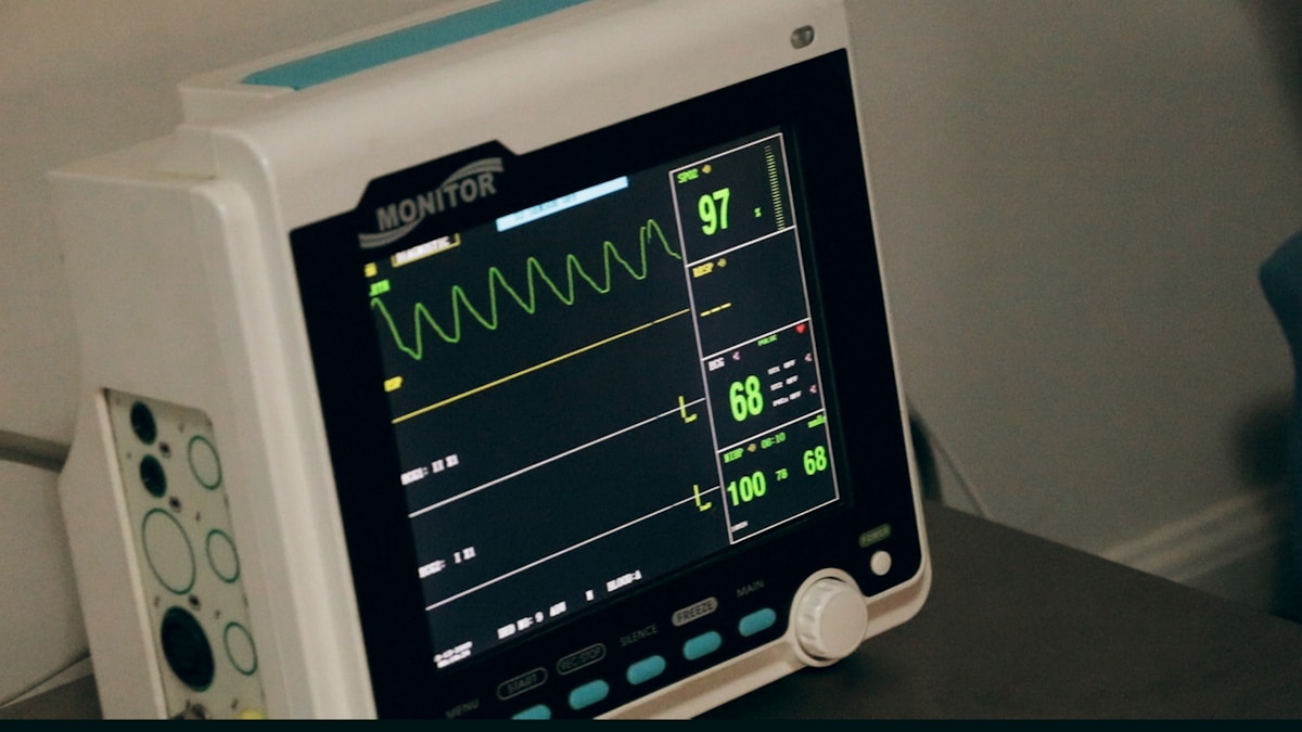 Moniteur médical affichant des données physiologiques en temps réel.