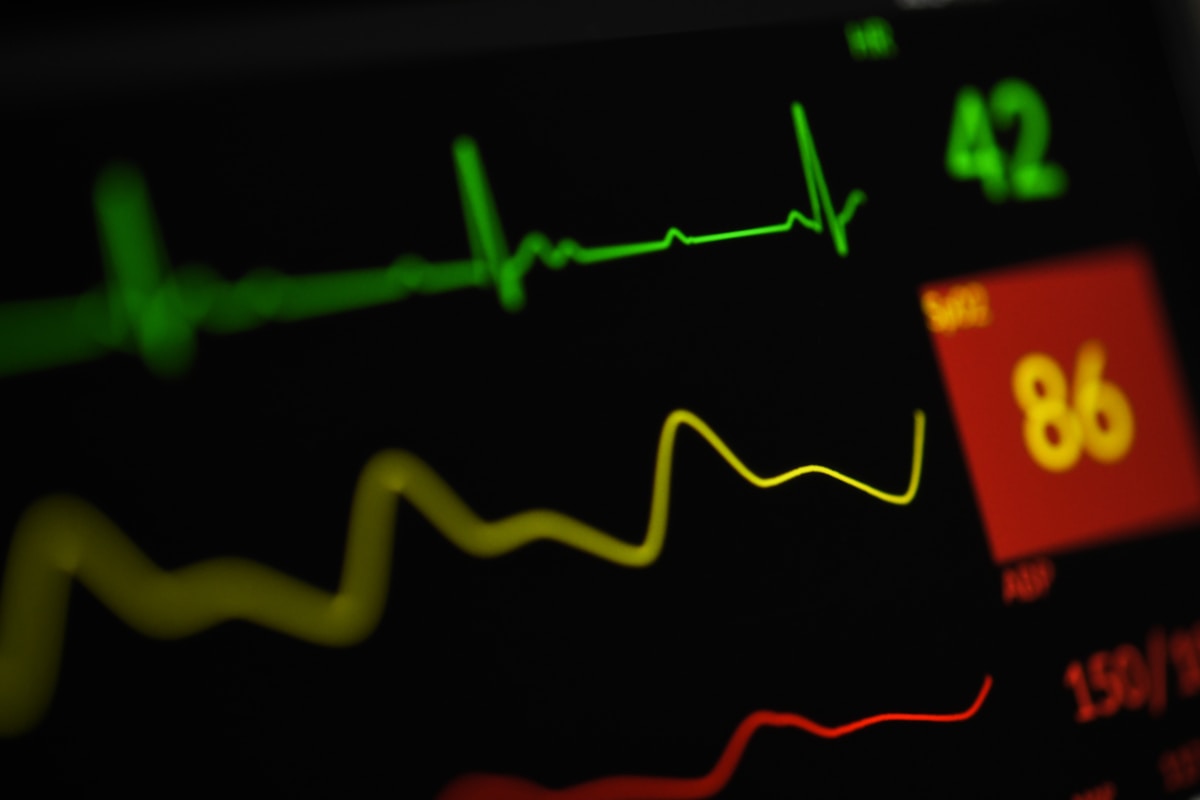 Graphique de données financières avec lignes de tendance vertes et rouges.